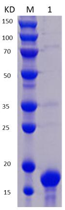 12% SDS-PAGE analysis profiles of purified MCR_RS00350-21-160 (CBB stained).